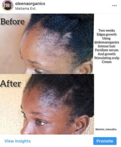 7 tips to grow back your edges